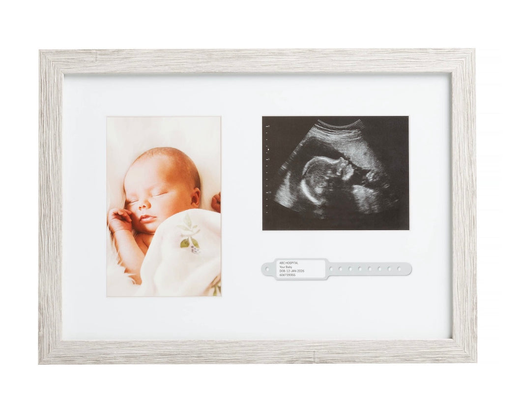 Bracelet/Sonogram Picture Frame